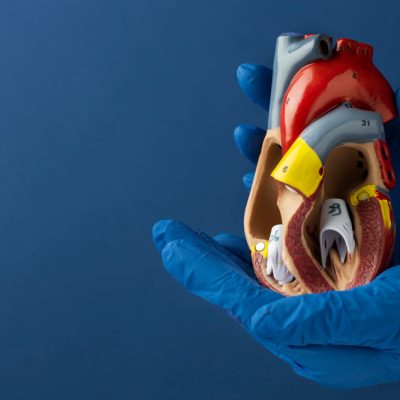Doenças Cardiovasculares Doenças Cardiovasculares