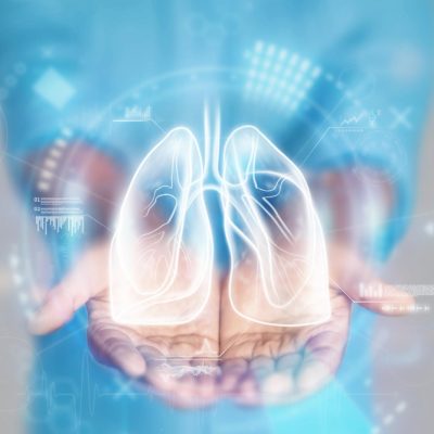 Doenças Respiratórias Crônicas Doenças Respiratórias Crônicas